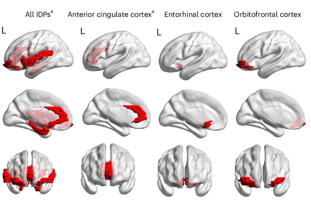 Open access visualization of 3D Plot, Protein Structure, Brain Regions, IDPs, Desikan-Killiany Cortical Atlas