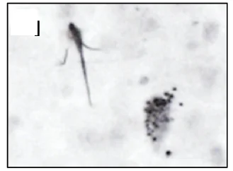 Open access visualization of Microscopy, Hippocampal Tissue Sections, Braak NFT Stage II, Braak NFT Stage VI, Immunohistochemistry