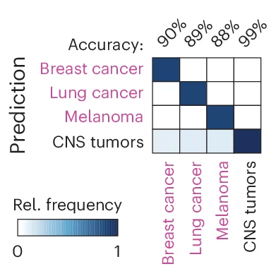 Open access visualization of Heatmap, Confusion Matrix, Predictions, CNS Tumors, Breast Cancer