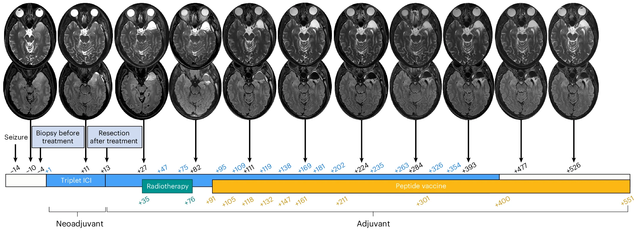 Open access visualization of Microscopy, Workflow, Magnetic Resonance Imaging, Gadolinium, T2-weighted