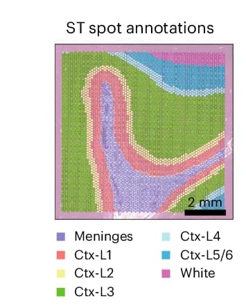 Open access visualization of Geo Map, ST Spots, FCX, Manual Annotation