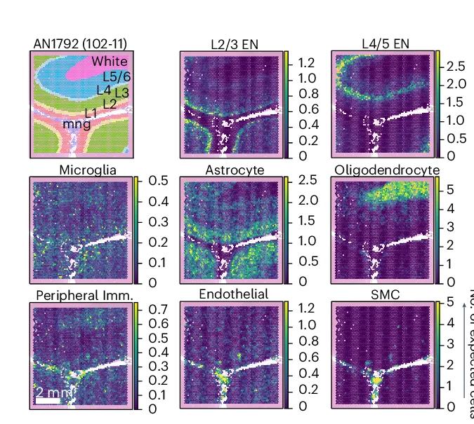 Open access visualization of Heatmap, Spatial Plots, Deconvoluted Cell Types, Cell Abundance