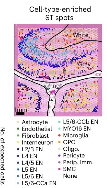 Open access visualization of Scatter Plot, Spatial Plots, Enriched ST Spots, Deconvoluted Cell Types