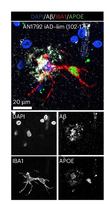 Open access visualization of Microscopy, Confocal Images, APOE, IBA1, Myeloid Cells