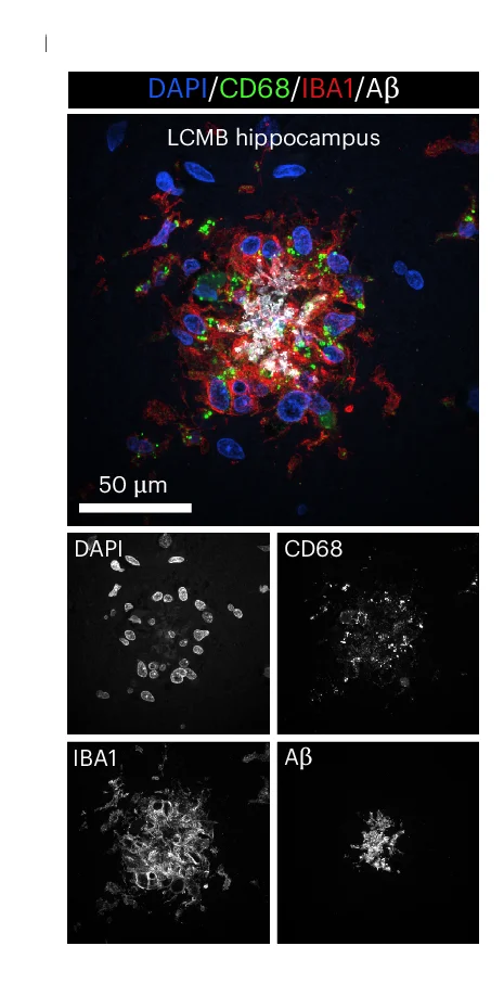 Open access visualization of Microscopy, Confocal Images, CD68, IBA1, Myeloid Cells