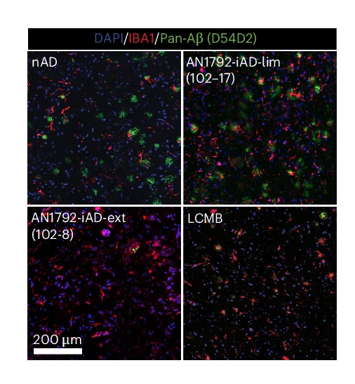 Open access visualization of Microscopy, Confocal Images, Pan-A, IBA1, FCX Brain Regions