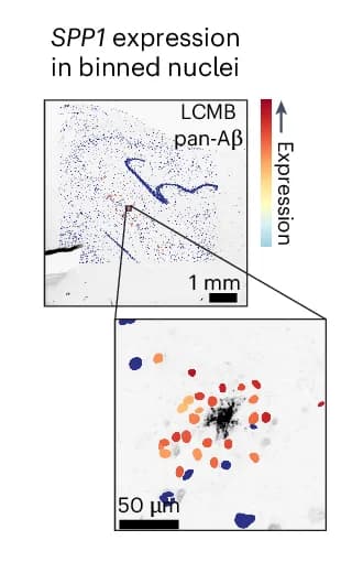 Open access visualization of Microscopy, Spatial Plots, SPP1 Expression, Binned Nuclei, A Plaques