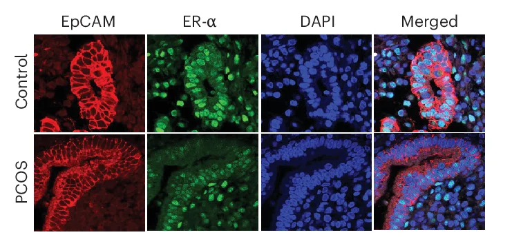 Open access visualization of Microscopy, Fluorescence Microscopy, Endometrial Tissue, PCOS, Control