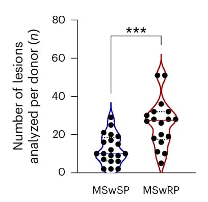 Open access visualization of Violin Plot, MSwRP Group, Lesions, Violin Plots, MannWhitney U Test