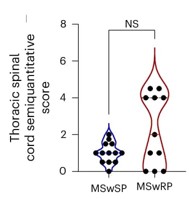 Open access visualization of Violin Plot, MSwRP Group, Thoracic Lesion Load, Violin Plots, MannWhitney U Test