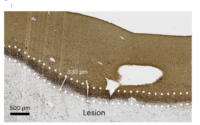 Open access visualization of Microscopy, Classical Mixed Lesions, Proteolipid Protein, HLA-DR, Quantifications