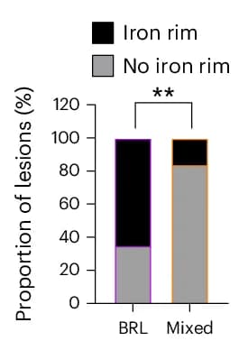 Open access visualization of Stacked Bar Plot, BRLs, Iron Rims, Classical Mixed Lesions, Fisher's Exact Test