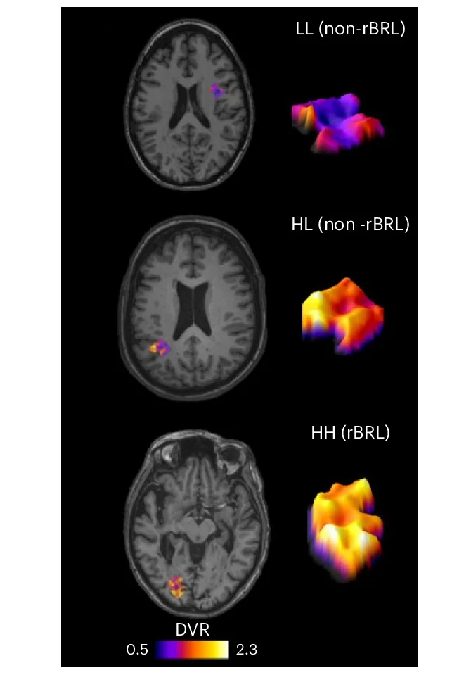 Open access visualization of Microscopy, 3D Plot, Heatmap, TSPO PET, rBRLs