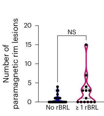 Open access visualization of Violin Plot, Patients, rBRLs, QSM+ Rim Lesions, Mann-Whitney U-test