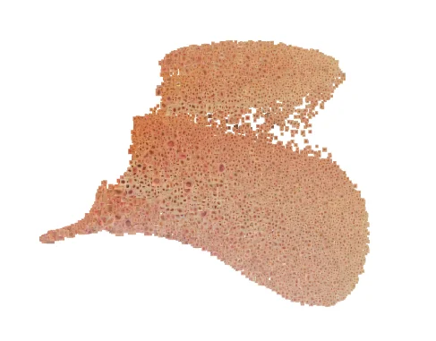Open access visualization of 3D Plot, UMAP Plot, PanDerm, Screening Results, Test Lesions