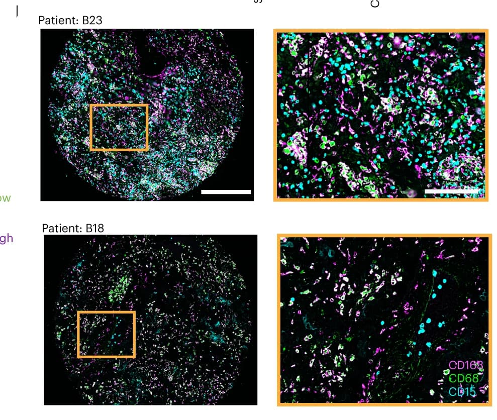 Open access visualization of Microscopy, CODEX, Tissue Cores, CD163, CD68