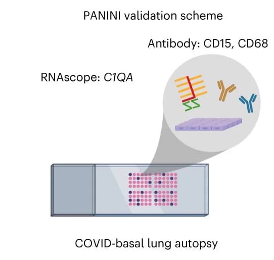 Open access visualization of Illustration, PANINI, C1Q Macrophages, COVID-19, C1QA mRNA