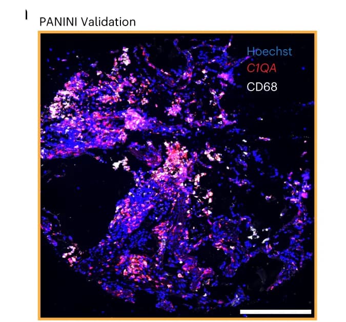 Open access visualization of Microscopy, Tissue Core, MARIO Prediction, C1QA Expression, Macrophages