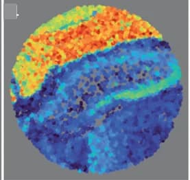 Open access visualization of Scatter Plot, Spatial Component, Choroid Plexus, Thalamus, Dentate Gyrus