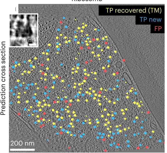 Open access visualization of Microscopy, Ribosomes, DeePiCt, Tomographic Slice, True Positives