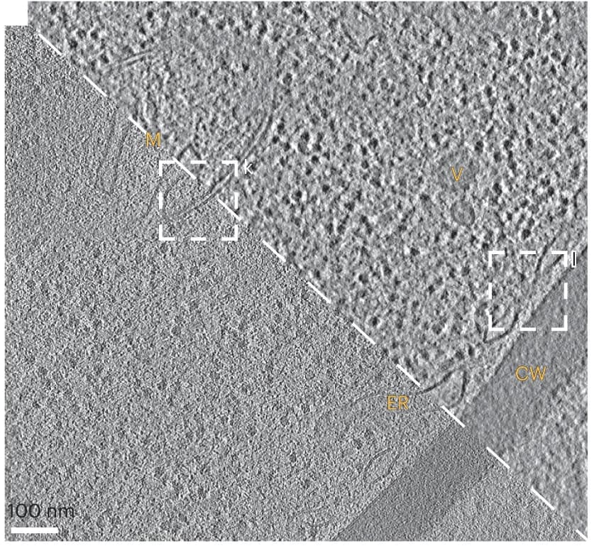 Open access visualization of Microscopy, Tomogram, Mitochondrion, Vesicle, ER