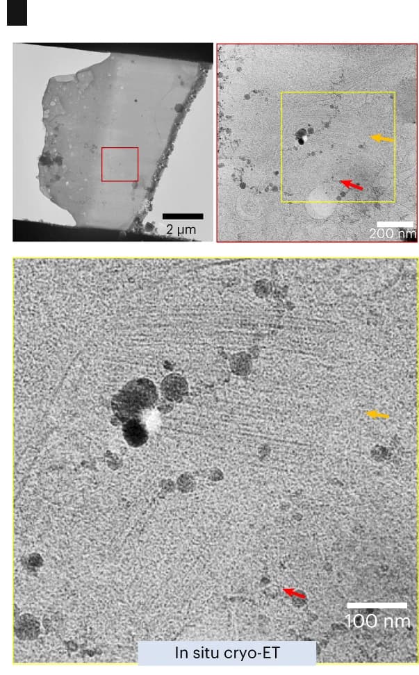 Open access visualization of Microscopy, Cryo-lamella, Cryo-transmission Electron Microscope, Cryo-ET, Cryo-EM Micrographs