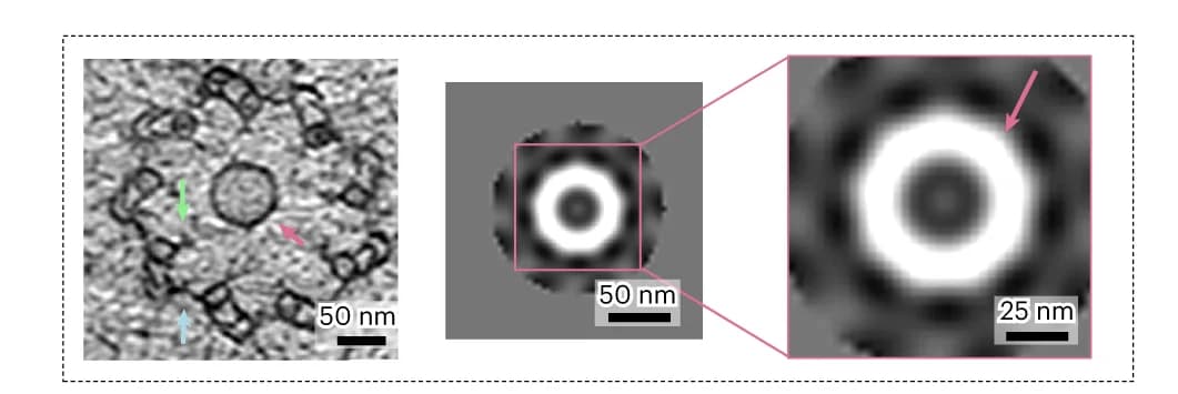 Open access visualization of Microscopy, RD2, A-C Linker, Pinhead, Tomogram