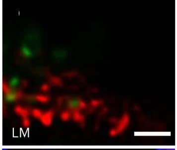 Open access visualization of Microscopy, Confocal Images, Virtual Lamellae
