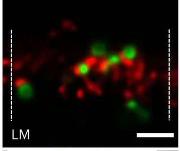 Open access visualization of Microscopy, Confocal Images, Virtual Lamellae, FIB Milling