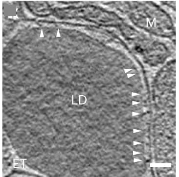 Open access visualization of Microscopy, Tomogram, Lipid Droplets, Mitochondrion, Tethers