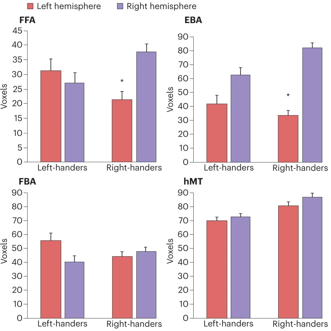 Open access visualization of Bar Plot, Error Bars, Clustered, Hemispheric Lateralization, Face Perception