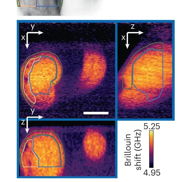 Open access visualization of Microscopy, Orthogonal Views, E-LSBM