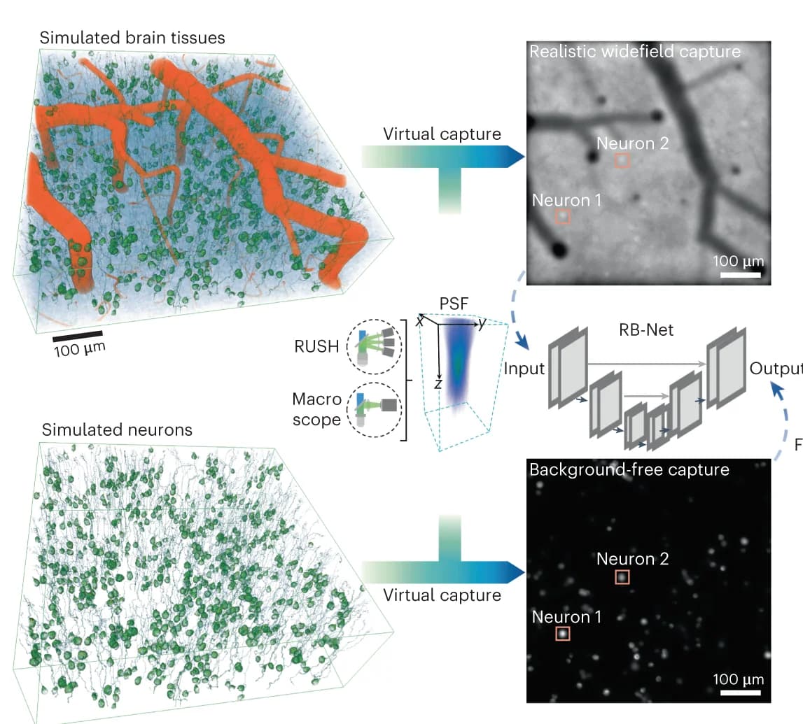 Open access visualization of Workflow, Illustration, Microscopy, RB-Net, DeepWonder