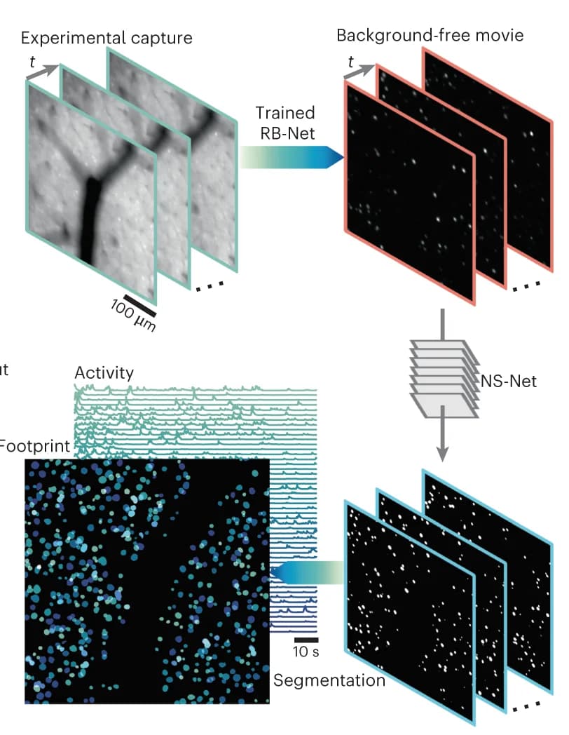 Open access visualization of Workflow, Microscopy, Line Plot, Scatter Plot, DeepWonder