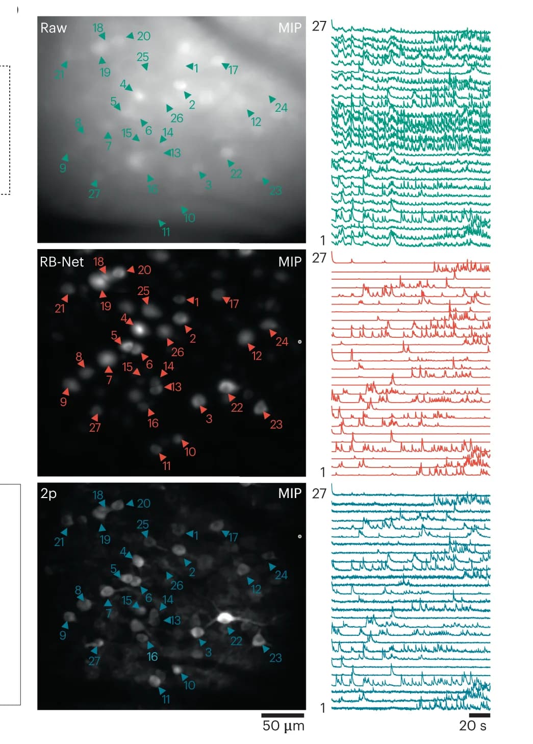 Open access visualization of Microscopy, Line Plot, Maximum Intensity Projection, Widefield Movie, RB-Net