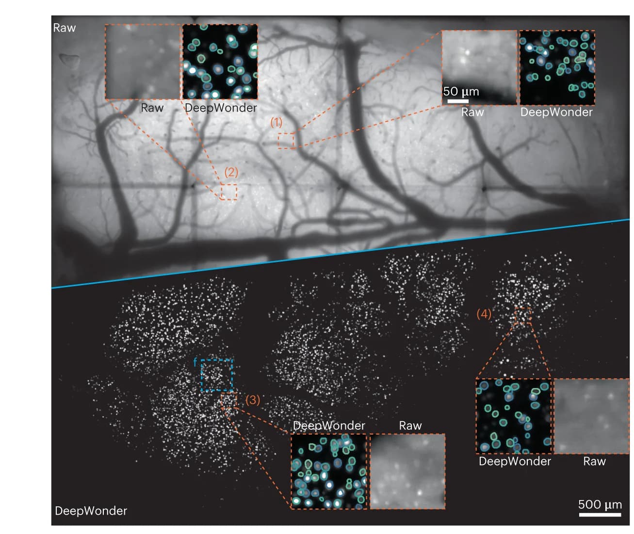 Open access visualization of Microscopy, RUSH Video, DeepWonder, Cortex, Segmentation