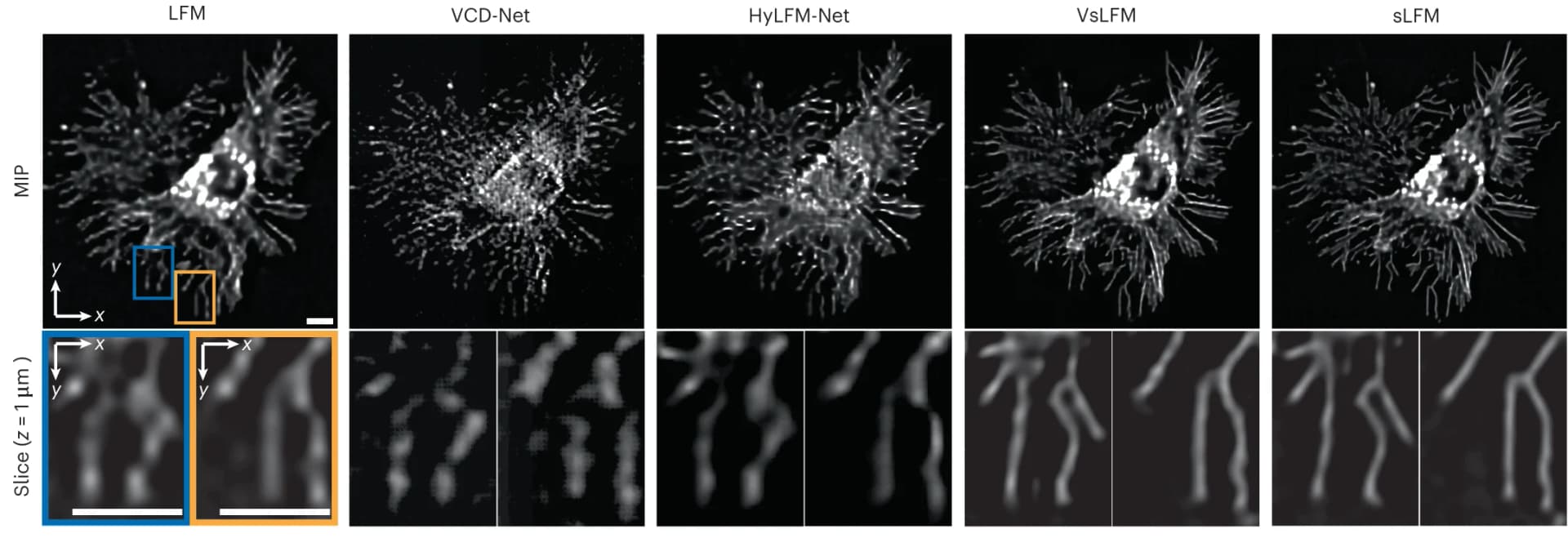 Open access visualization of Microscopy, MIP, L929 Cell, Membrane Labeling, LFM
