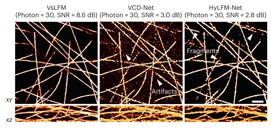 Open access visualization of Microscopy, VsLFM, VCD-Net, HyLFM-Net, Poisson-Gaussian Noise