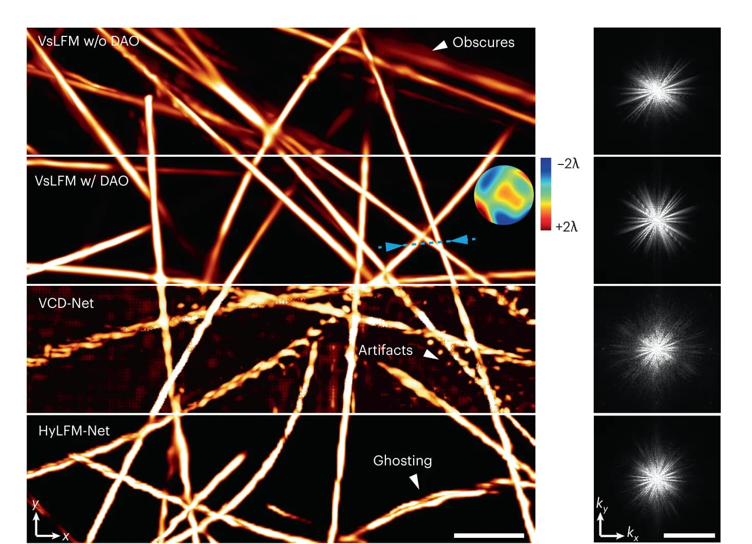 Open access visualization of Microscopy, Reconstructed MIPs, Aberration Wavefront, VsLFM, DAO