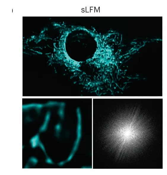 Open access visualization of Microscopy, sLFM, Ground Truth