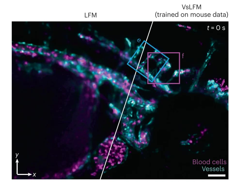 Open access visualization of Microscopy, MIPs, LFM, VsLFM, Blood Cells