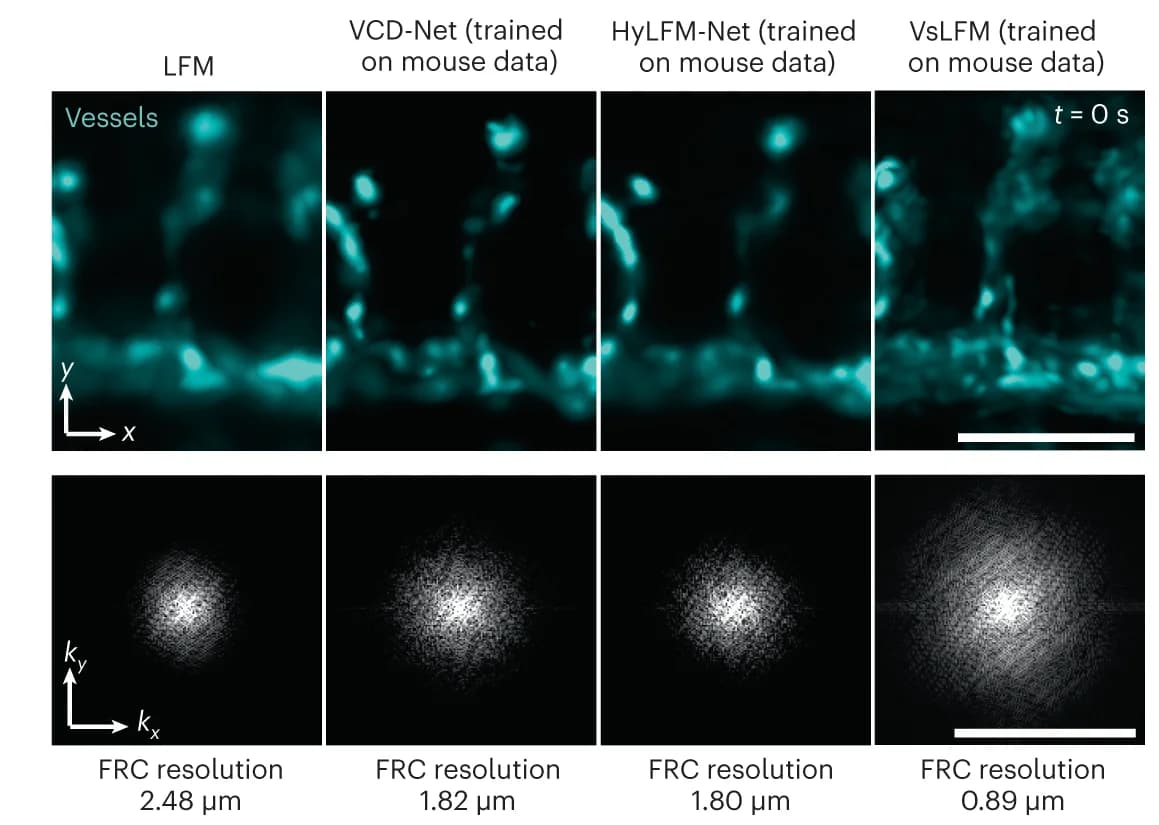 Open access visualization of Microscopy, Photo, MIPs, Vessels, Fourier Transforms