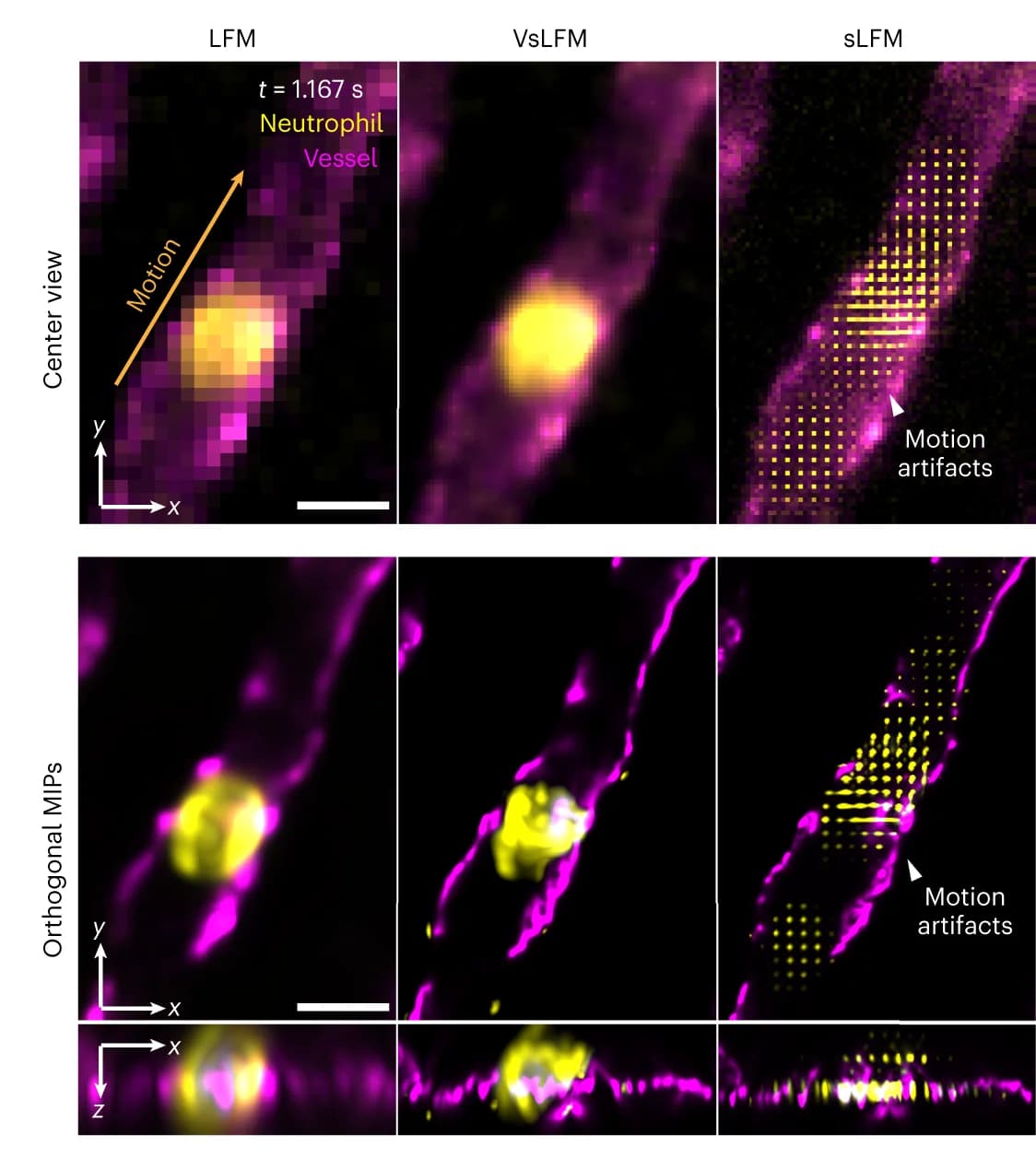 Open access visualization of Microscopy, Spatial-angular components, Reconstructed MIPs, LFM, VsLFM