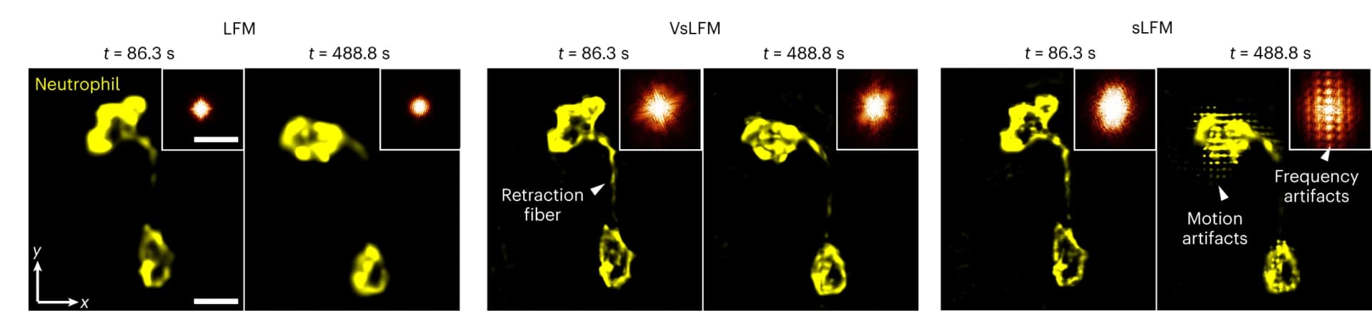 Open access visualization of Microscopy, Neutrophils, Mouse Liver, High-speed migration, LFM