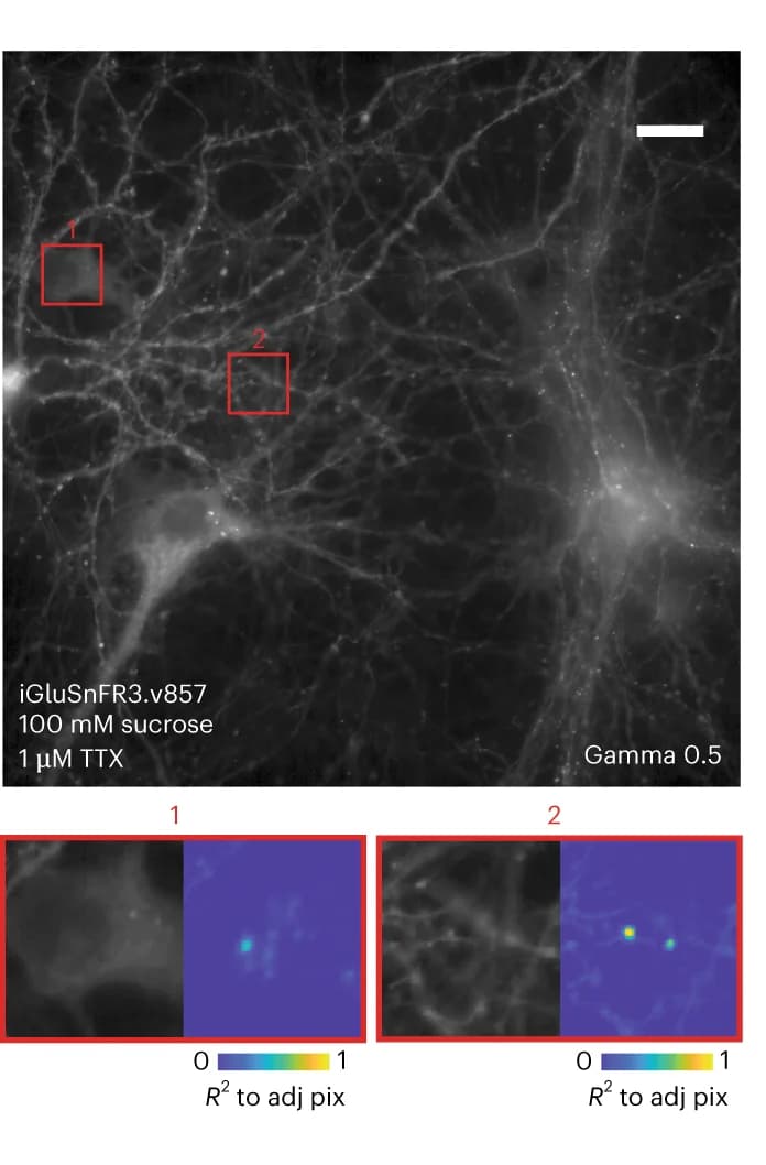 Open access visualization of Microscopy, Heatmap, Epifluorescence Image, Neuronal Culture, Soma