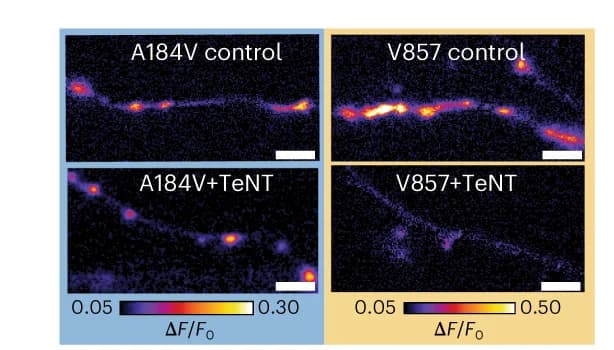 Open access visualization of Microscopy, SF-iGluSnFR.A184V, v857, Field stimulation, Calcium concentration