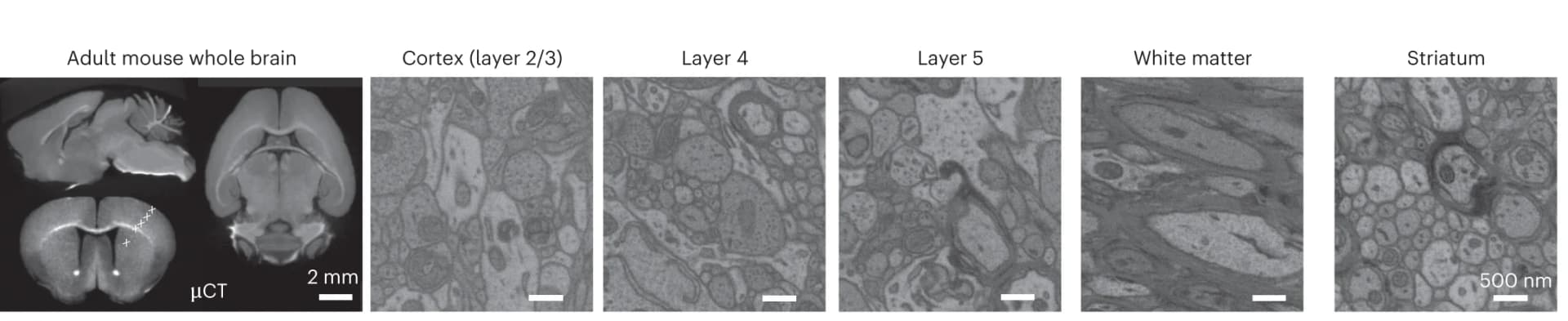 Open access visualization of Microscopy, High-contrast staining, Mouse brains, EM images, Superficial cortex