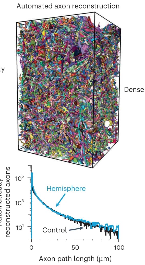 Open access visualization of Line Plot, 3D Plot, Microscopy, Axon Reconstruction, Striatum Datasets