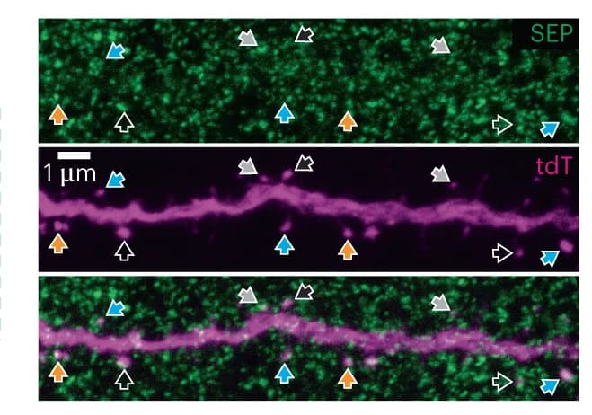 Open access visualization of Microscopy, High-Resolution Imaging, Fixed-Slice Tissue, Endogenous Fluorescence, Airyscan