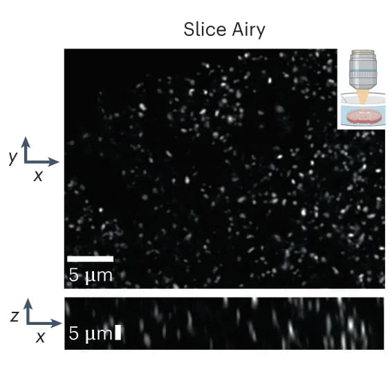 Open access visualization of Microscopy, XY Slice, XZ Slice, Imaging Modalities, SEP-GluA2 Mice